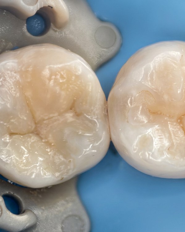 Resinas dentales